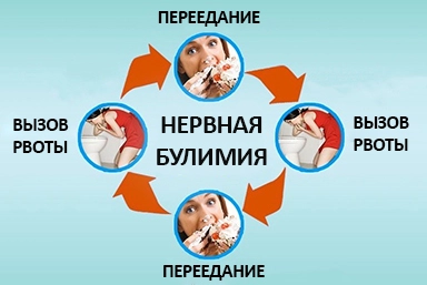Лечение булимии в Заволжье